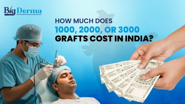 How Much Does 1000, 2000, or 3000 Grafts Cost in India? Big Derma’s Expert Guide