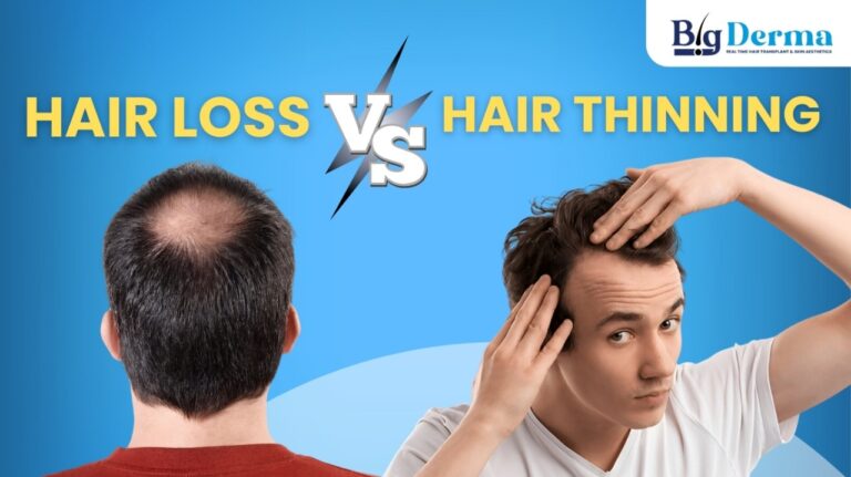 Hair Loss vs Hair Thinning: What’s Really Happening to Your Hair?