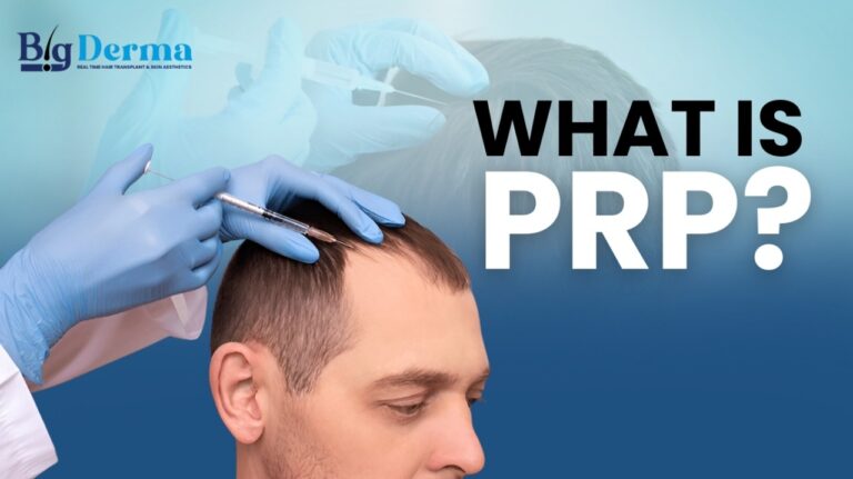 What is PRP? The Natural Therapy for Hair Growth