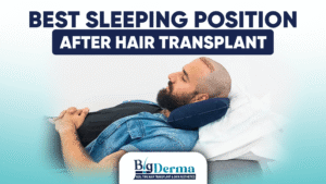 Best sleeping position after hair transplant
