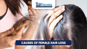 causes of female hair loss