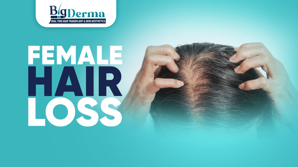 female hair loss