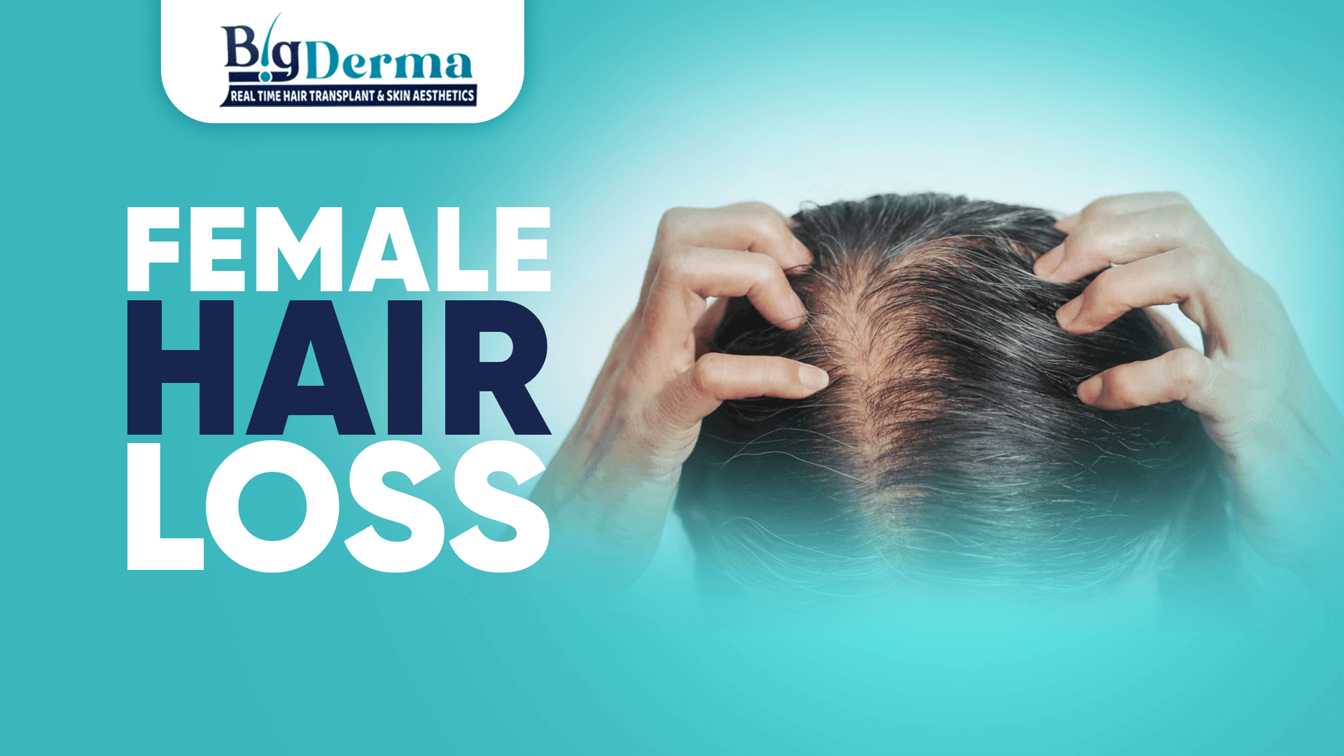 female hair loss