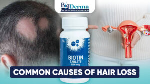 hair loss reasons