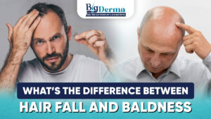 Difference between hair fall and baldness