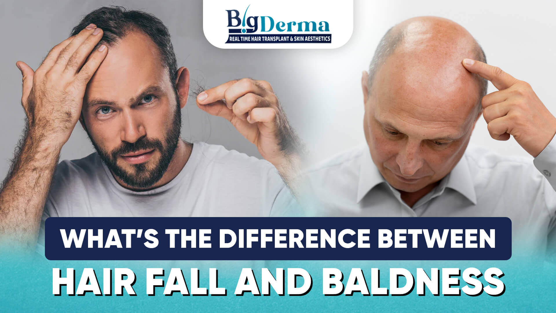 Difference between hair fall and baldness