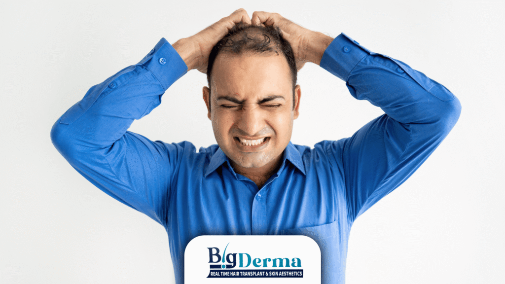 Early Signs You May Need a Hair Transplant