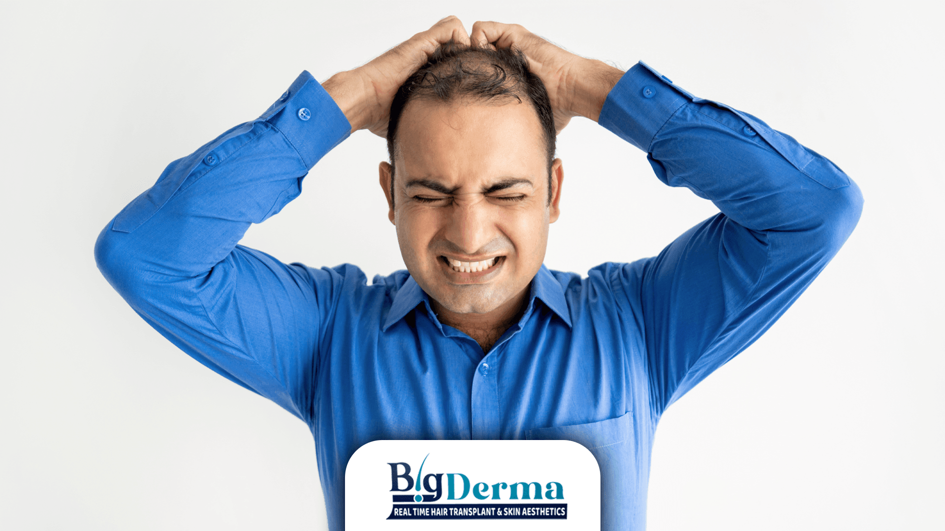 Early Signs You May Need a Hair Transplant