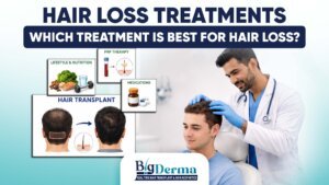 Hair Loss Treatment