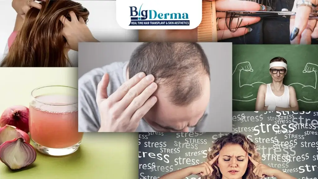 Prp treatment in kolkata